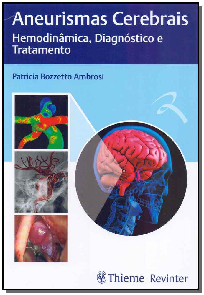 Aneurismas Cerebrais