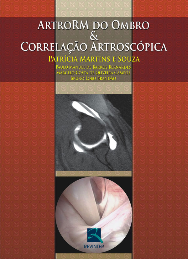 ArtroRM do Ombro & Correlação Artroscópica
