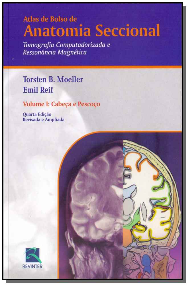 Atlas de Bolso de Anatomia Seccional - Tomografia Computadorizada e Ressonância Magnética - Volume I
