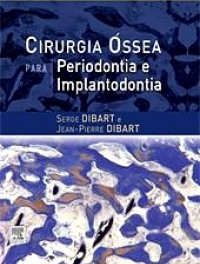 Cirurgia óssea para periodontia e implantodontia