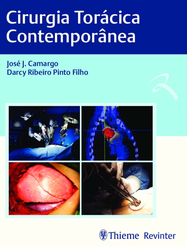Cirurgia Torácica Contemporânea