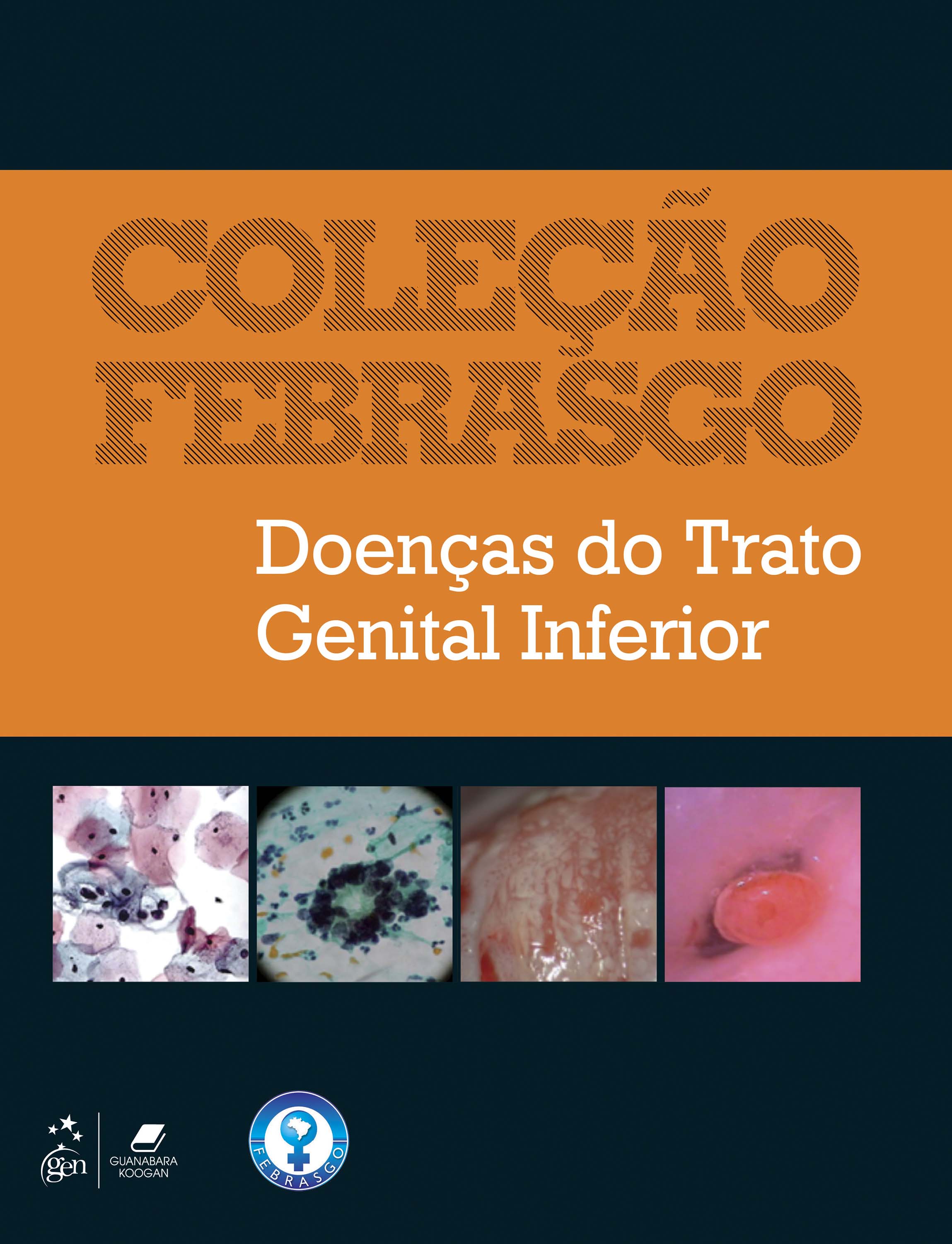 Coleção Febrasgo - Doenças do Trato Genital Inferior