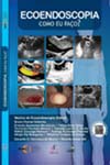 Ecoendoscopia como eu faço?