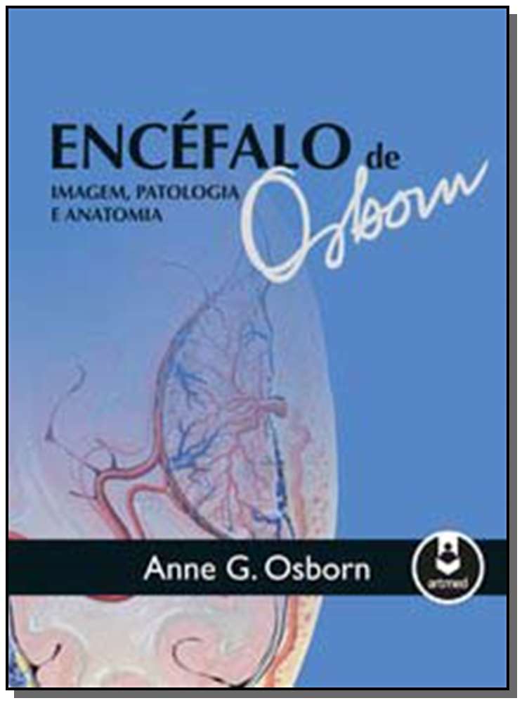 Encéfalo de Osborn