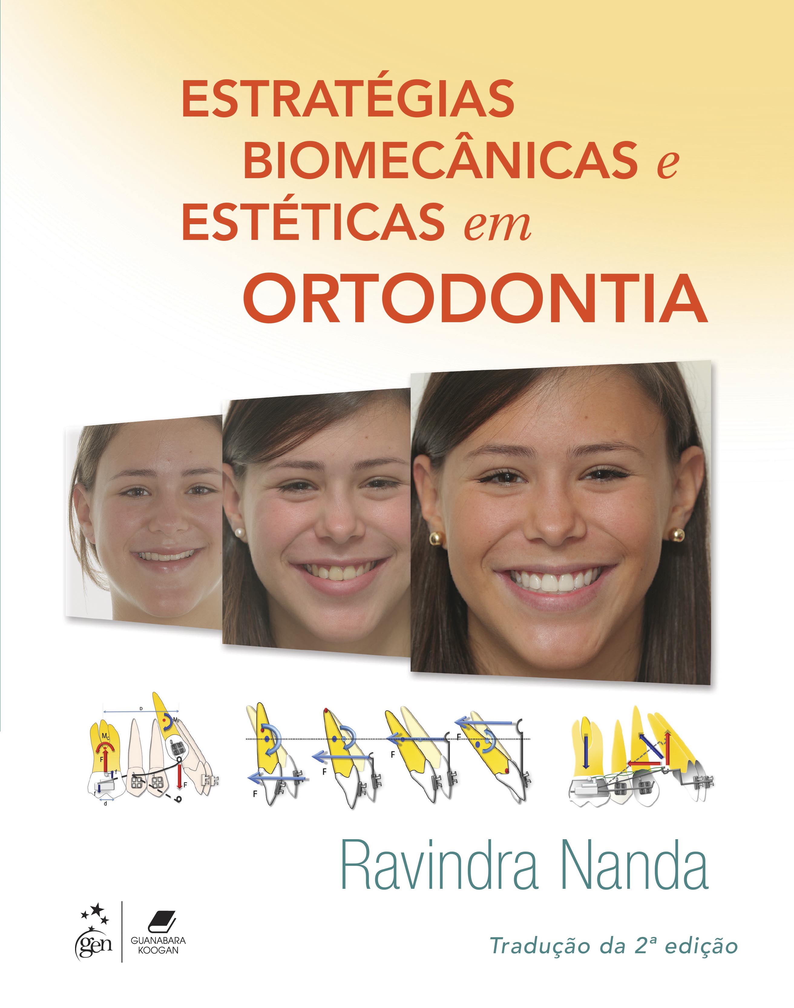 Estratégias Biomecânicas e Estéticas em Ortodontia