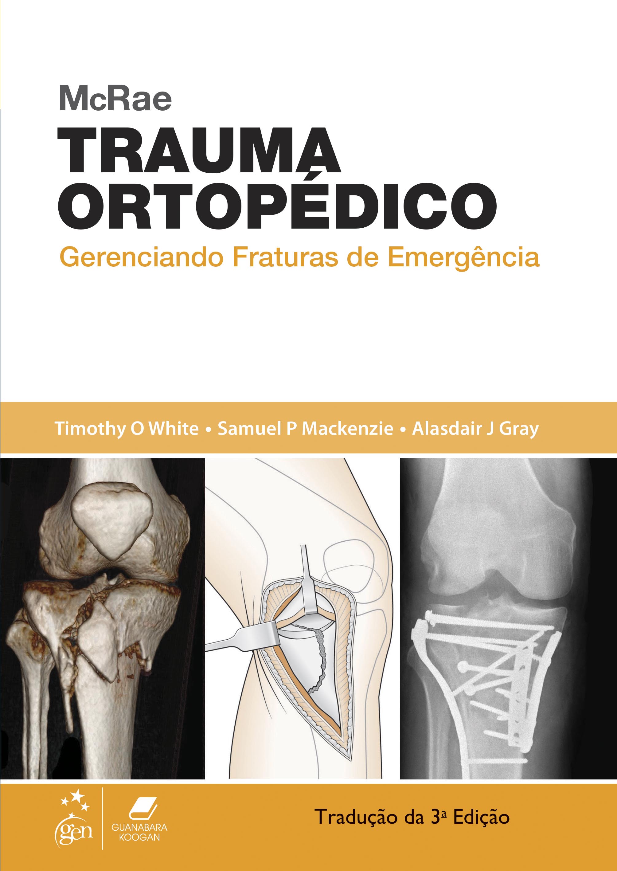 McRae Trauma Ortopédico - Gerenciando Fraturas de Emergência