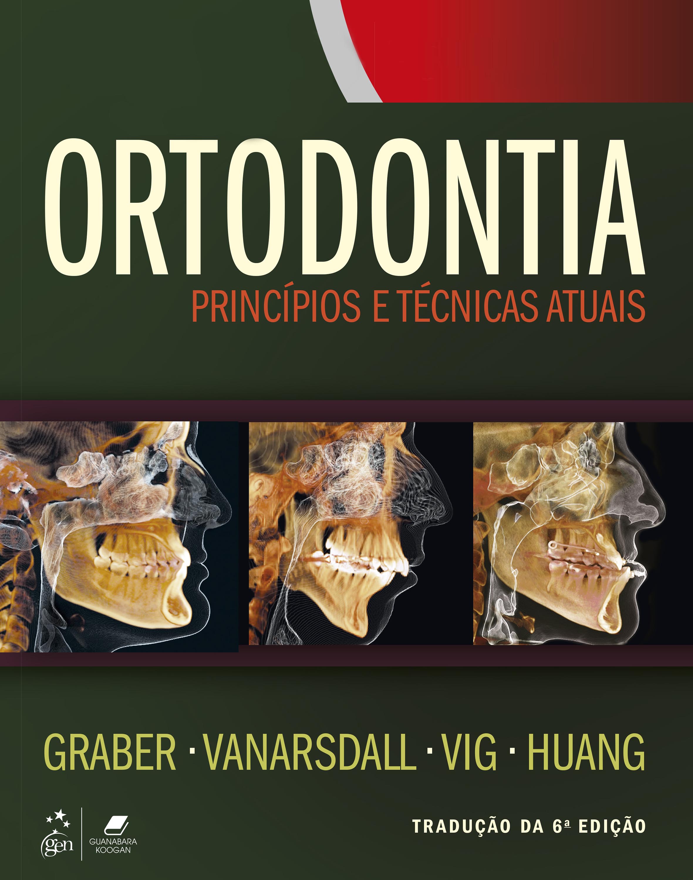 Ortodontia - Princípios e Técnicas Atuais