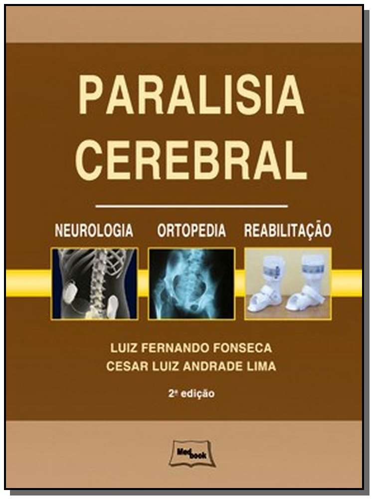 Paralisia cerebral - Neurologia, ortopedia e reabilitação