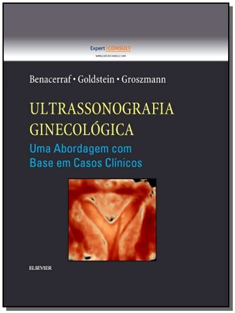 Ultrassonografia Ginecológica - Uma Abordagem com Base em Casos Clínicos